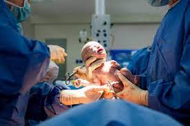 Женщина с фиброзом легких родила младенца в Шымкенте