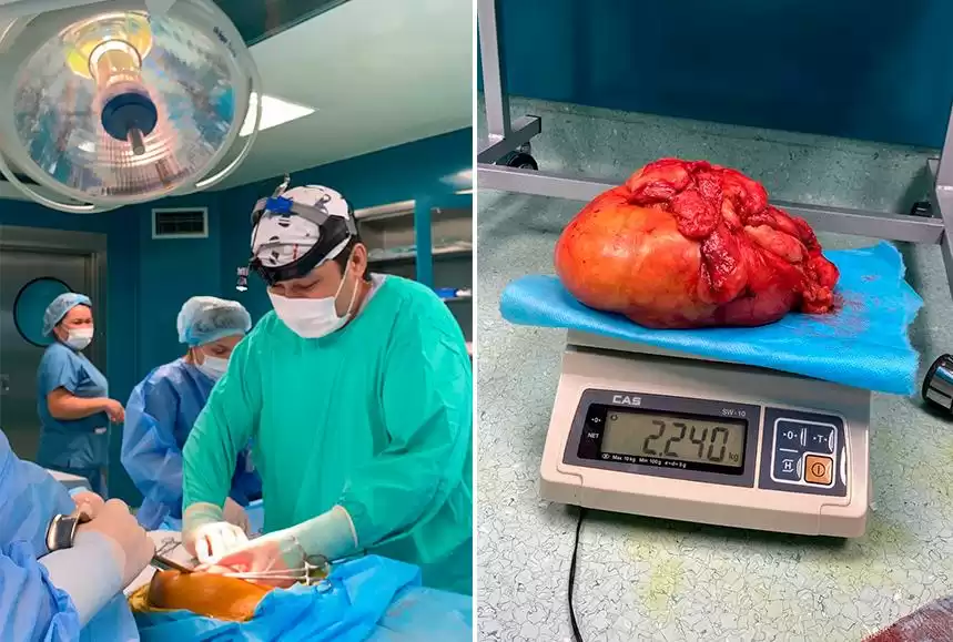 Врачи удалили двухкилограммовую опухоль у пациента в Алматы